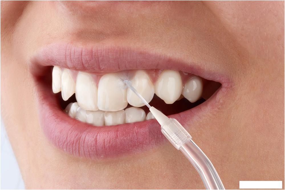 Электрические зубные щетки и ирригаторы Sencor SOI 1311GD